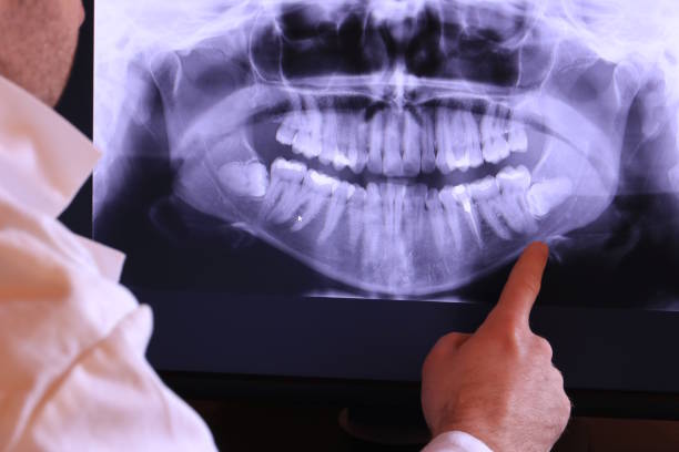 Best After-Hours Emergency Dentist in Marysville, KS