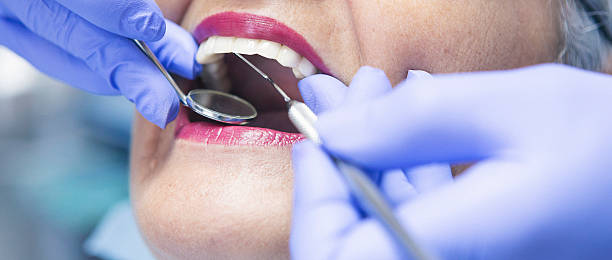 Best Emergency Wisdom Teeth Removal in Marysville, KS